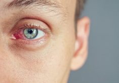 nietypowe choroby oczu